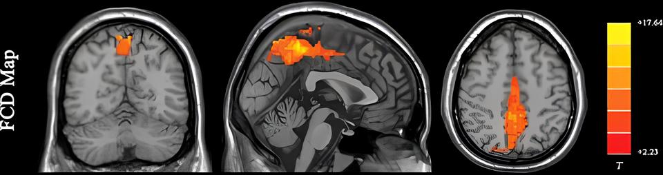 O Futuro da Neurociência: Como o Mindeye2 Está Redefinindo a Fronteira Entre o Cérebro e a Imagem 3 O Futuro da Neurociência: Como o Mindeye2 Está Redefinindo a Fronteira Entre o Cérebro e a Imagem O Futuro da Neuroci ncia Como o Mindeye2 Est Redefinindo a Fronteira Entre o C rebro e a Imagem O Futuro da Neurociência: Como o Mindeye2 Está Redefinindo a Fronteira Entre o Cérebro e a Imagem