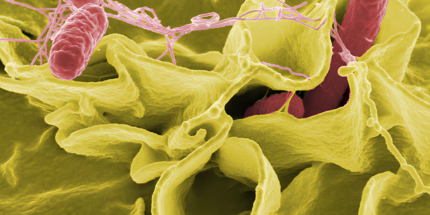 Surto de Salmonela em Hotel Espanhol: Por Que Centenas de Portugueses Estão Presos em um Pesadelo Tropical? 1 Surto de Salmonela em Hotel Espanhol: Por Que Centenas de Portugueses Estão Presos em um Pesadelo Tropical? Surto de Salmonela em Hotel Espanhol Por Que Centenas de Portugueses Est o Presos em um Pesadelo Tropical Surto de Salmonela em Hotel Espanhol: Por Que Centenas de Portugueses Estão Presos em um Pesadelo Tropical?